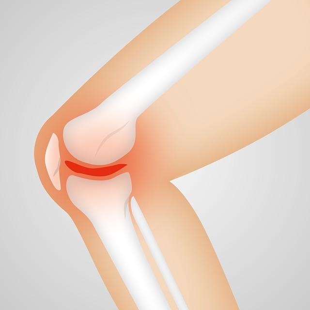 Jaké jsou nejčastější chyby‌ při cvičení pro ‌artrozu kolene a jak se jim vyhnout?